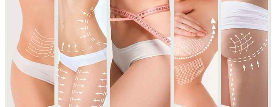 Trattamenti corpo rimodellanti e anticellulite, illustrazione con frecce e linee sulle zone di addome, fianchi, glutei e cosce per migliorare tono e silhouette