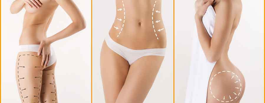 Trattamenti corpo rimodellanti e anticellulite, illustrazione con frecce e linee sulle zone di addome, fianchi, glutei e cosce per migliorare tono e silhouette